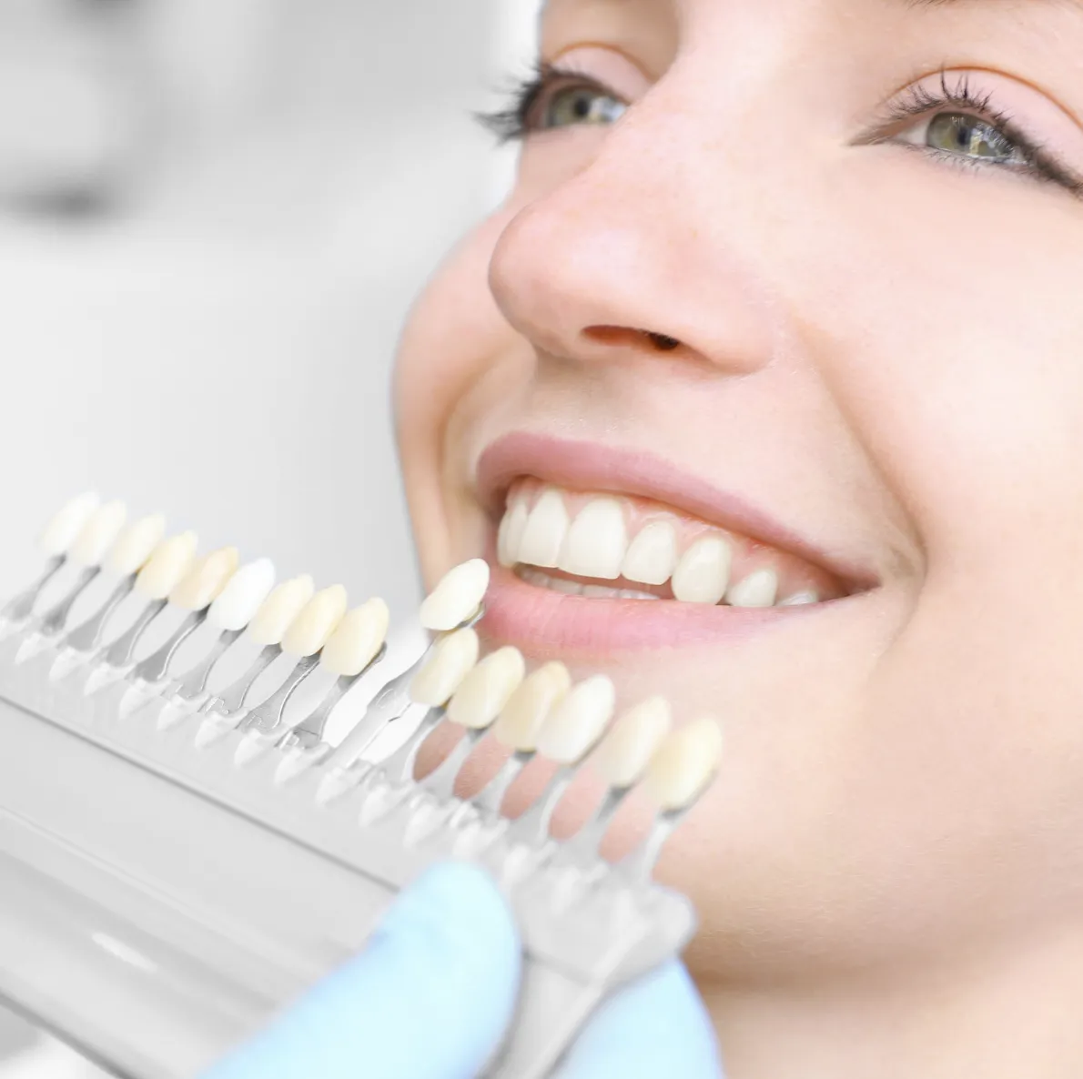 29266 teeth whitening aftercare dublin