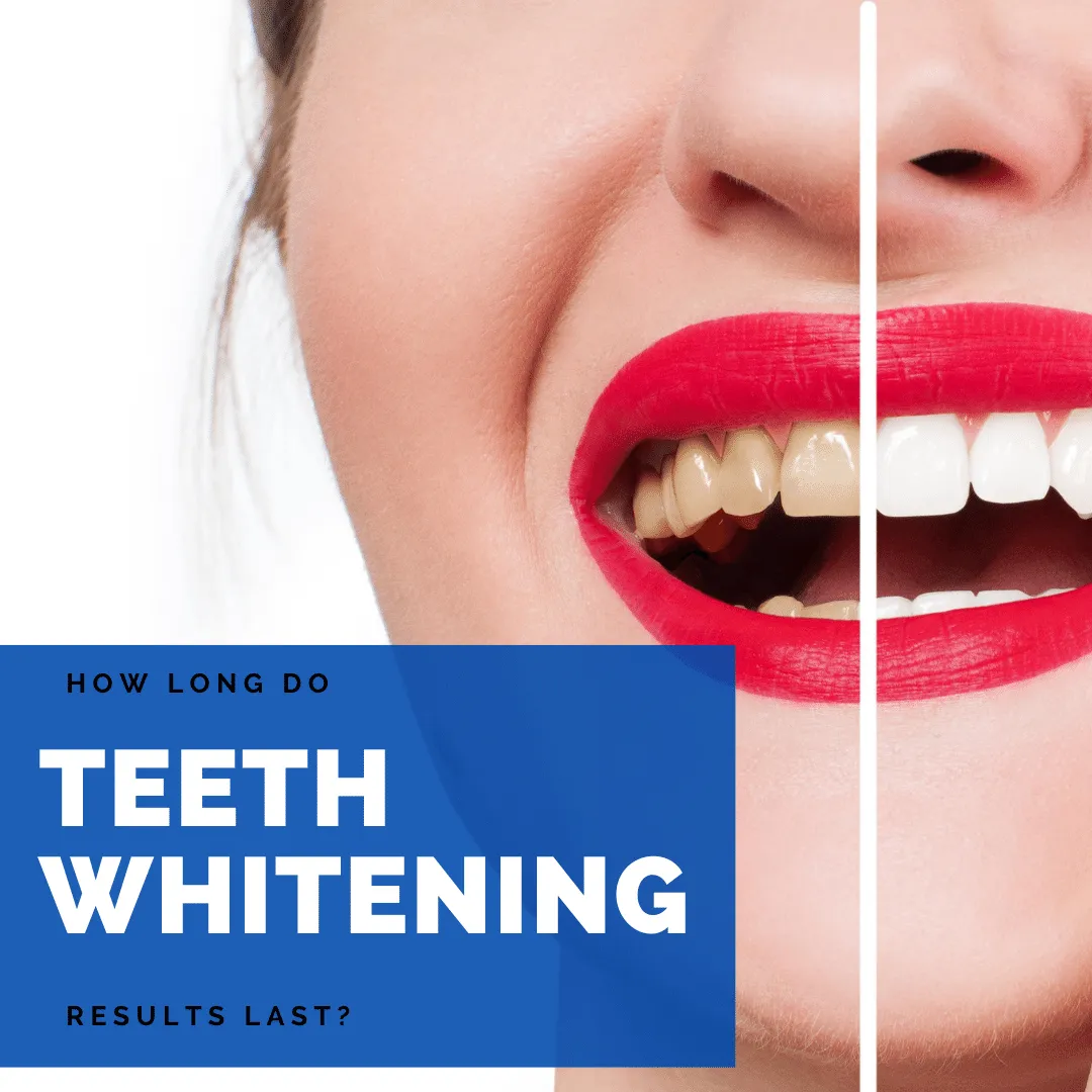 29272 teeth whitening guide image2