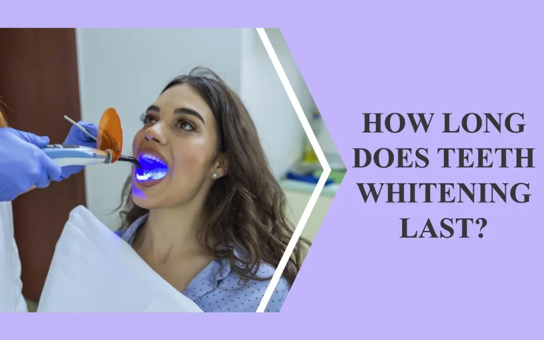 29272 teeth whitening guide image4