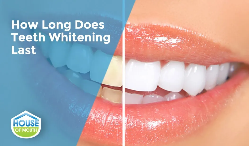 29272 teeth whitening guide image5