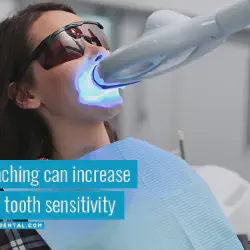/img/29273-choosing-the-right-whitening-method.webp