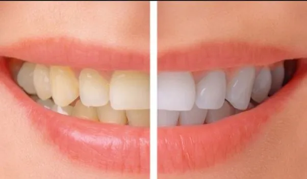 29278 oral hygiene