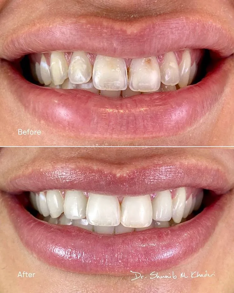 /img/29286-dentist-negotiation.webp