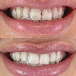 /img/29286-dentist-negotiation.webp