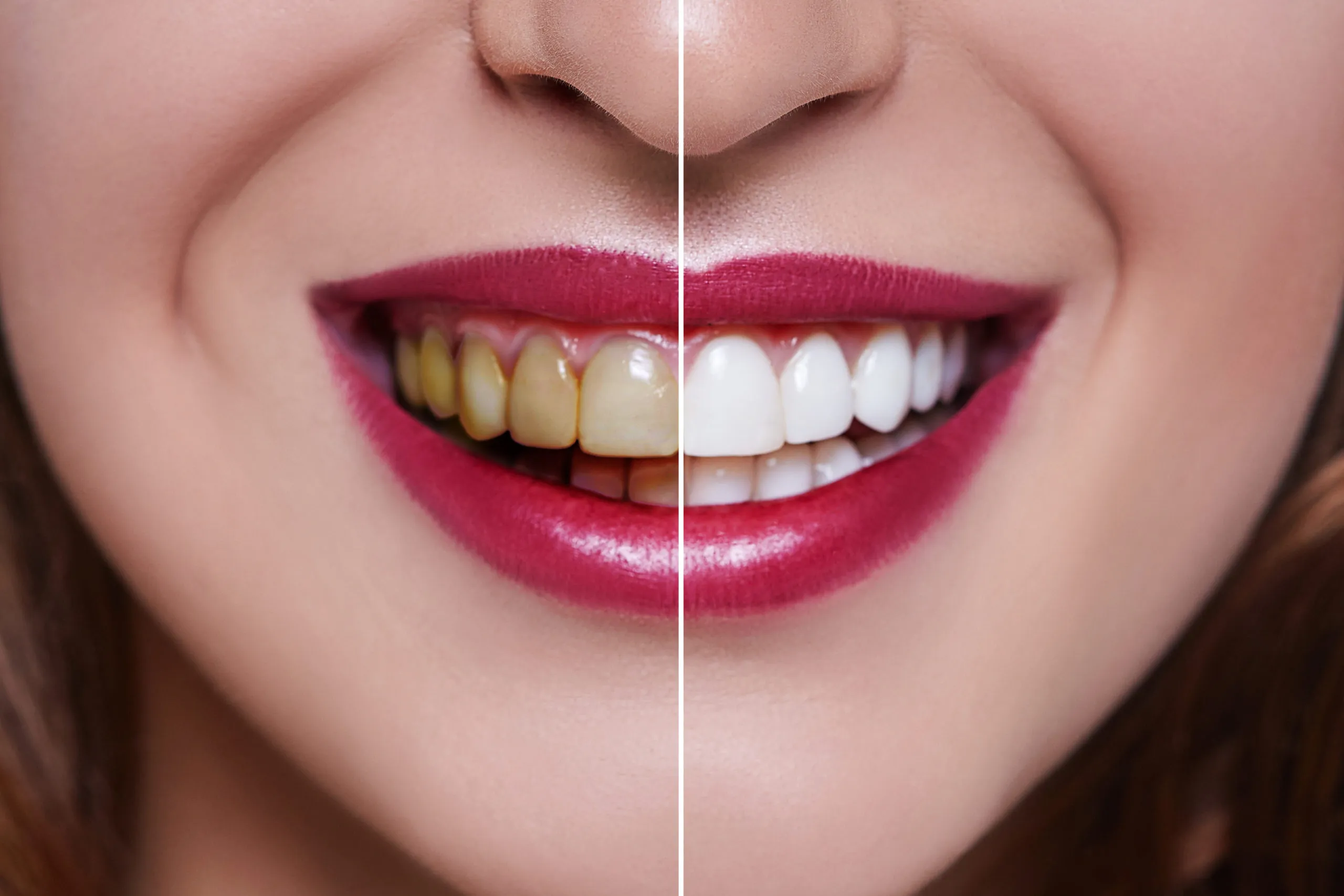 /img/29293-oral-hygiene.webp