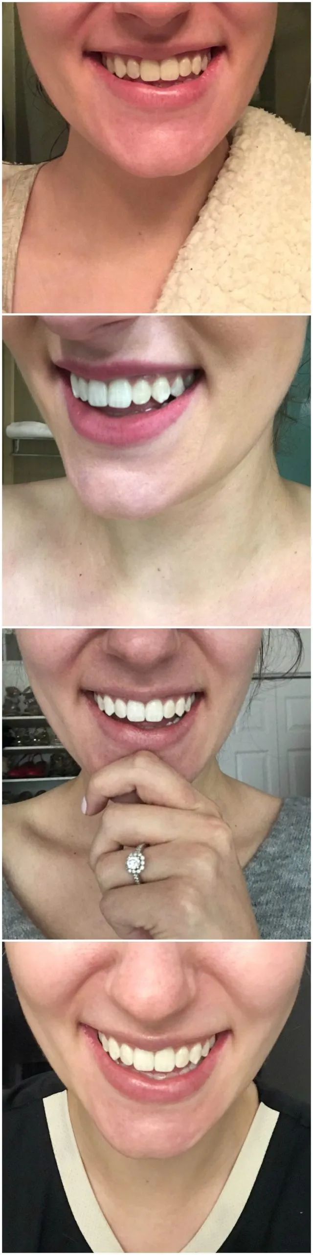 29297 crest whitening strips image3