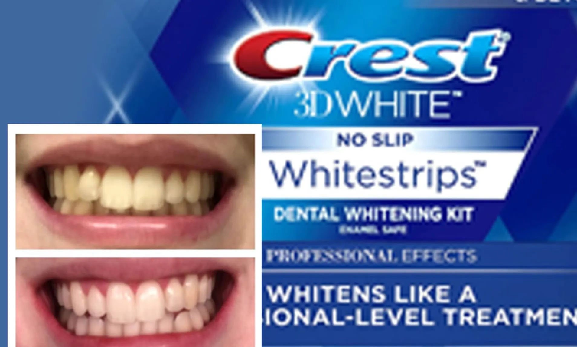 /img/29297-crest-whitening-strips-image7.webp