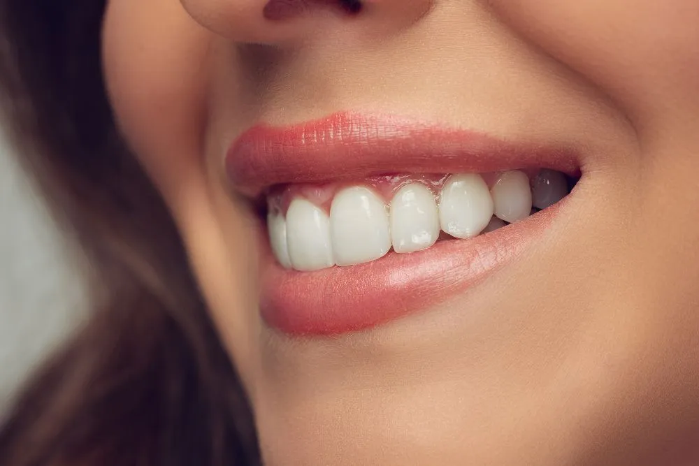 /img/29300-tooth-whitening-gum-burn-7.webp