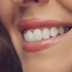 /img/29300-tooth-whitening-gum-burn-7.webp
