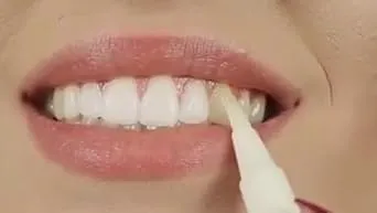 /img/29305-teeth-whitening-oral-care.webp