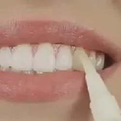 /img/29305-teeth-whitening-oral-care.webp