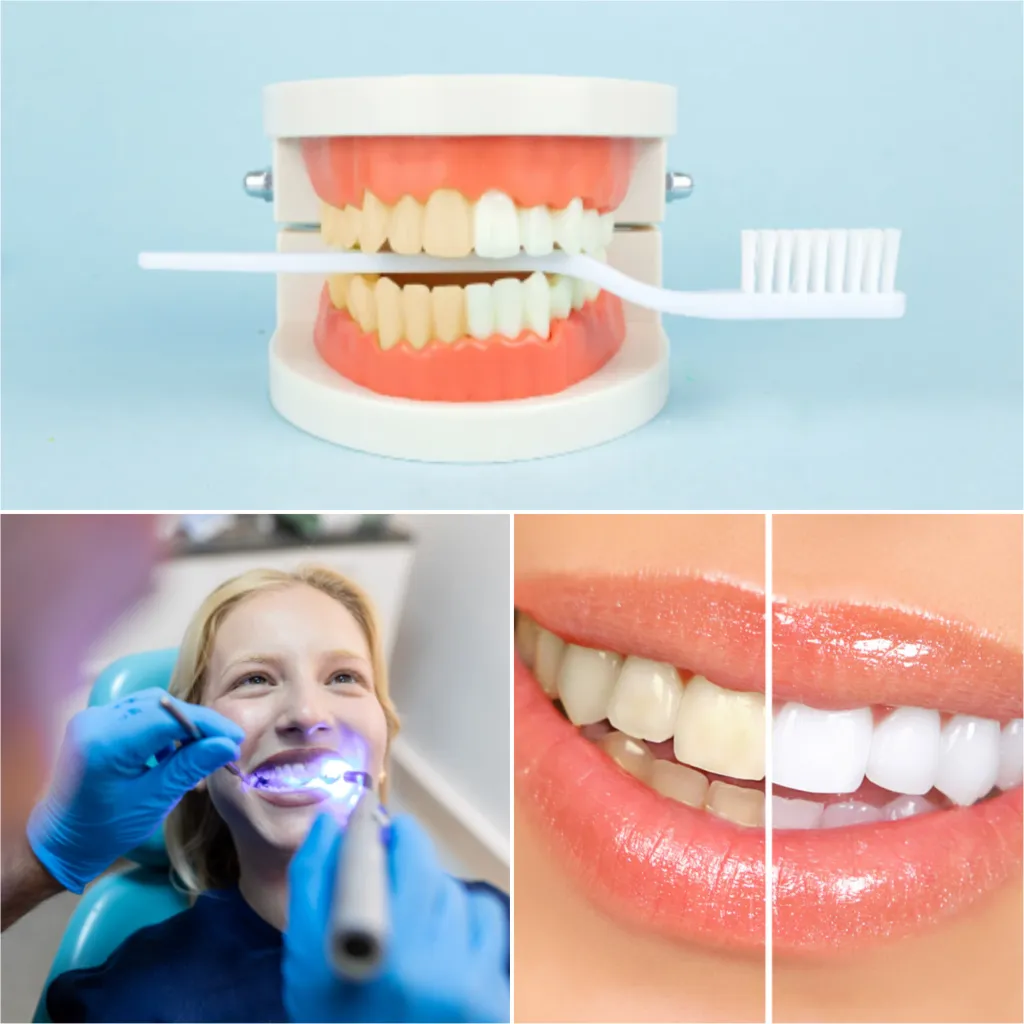 /img/29307-nyc-tooth-whitening-safe-effective.webp