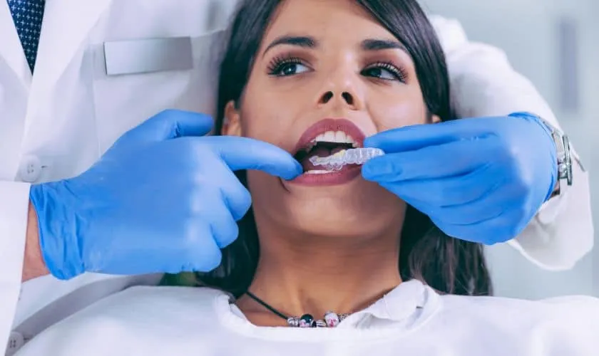 29312 teeth whitening slc 1