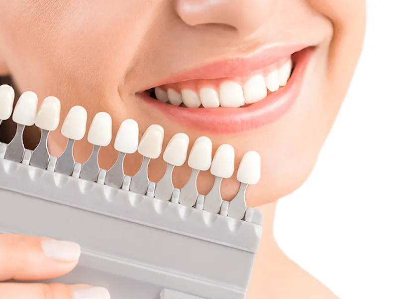 /img/29312-whitening-toothpaste.webp