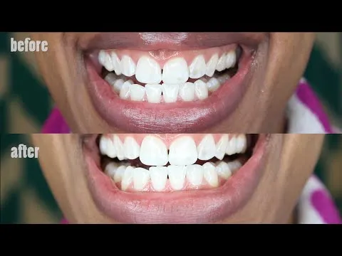 /img/29313-activated-charcoal-toothbrush.webp