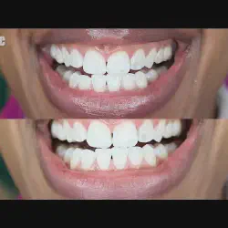 /img/29313-activated-charcoal-toothbrush.webp