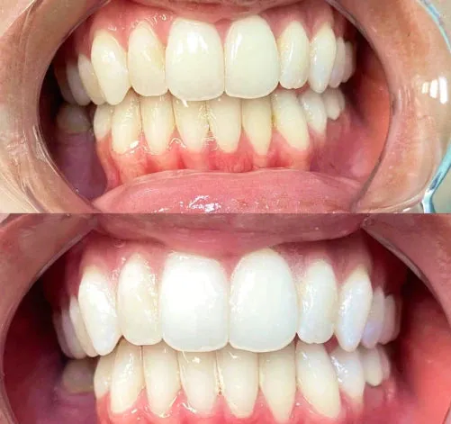 29314 teeth whitening franchise image1