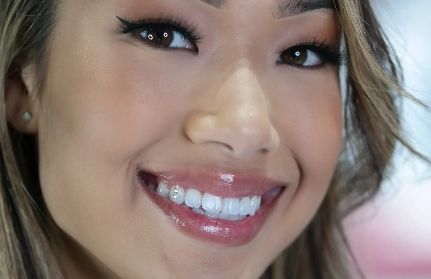 29314 teeth whitening franchise image3
