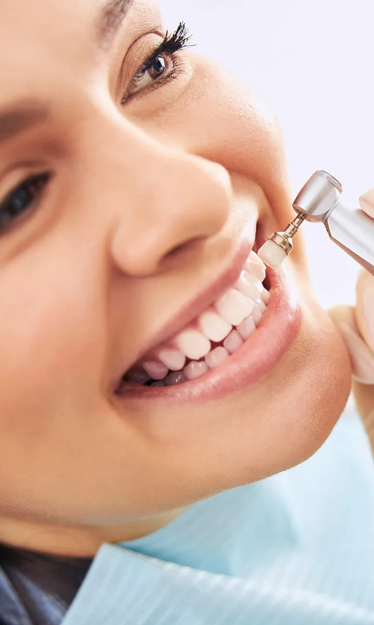 29314 teeth whitening franchise image6