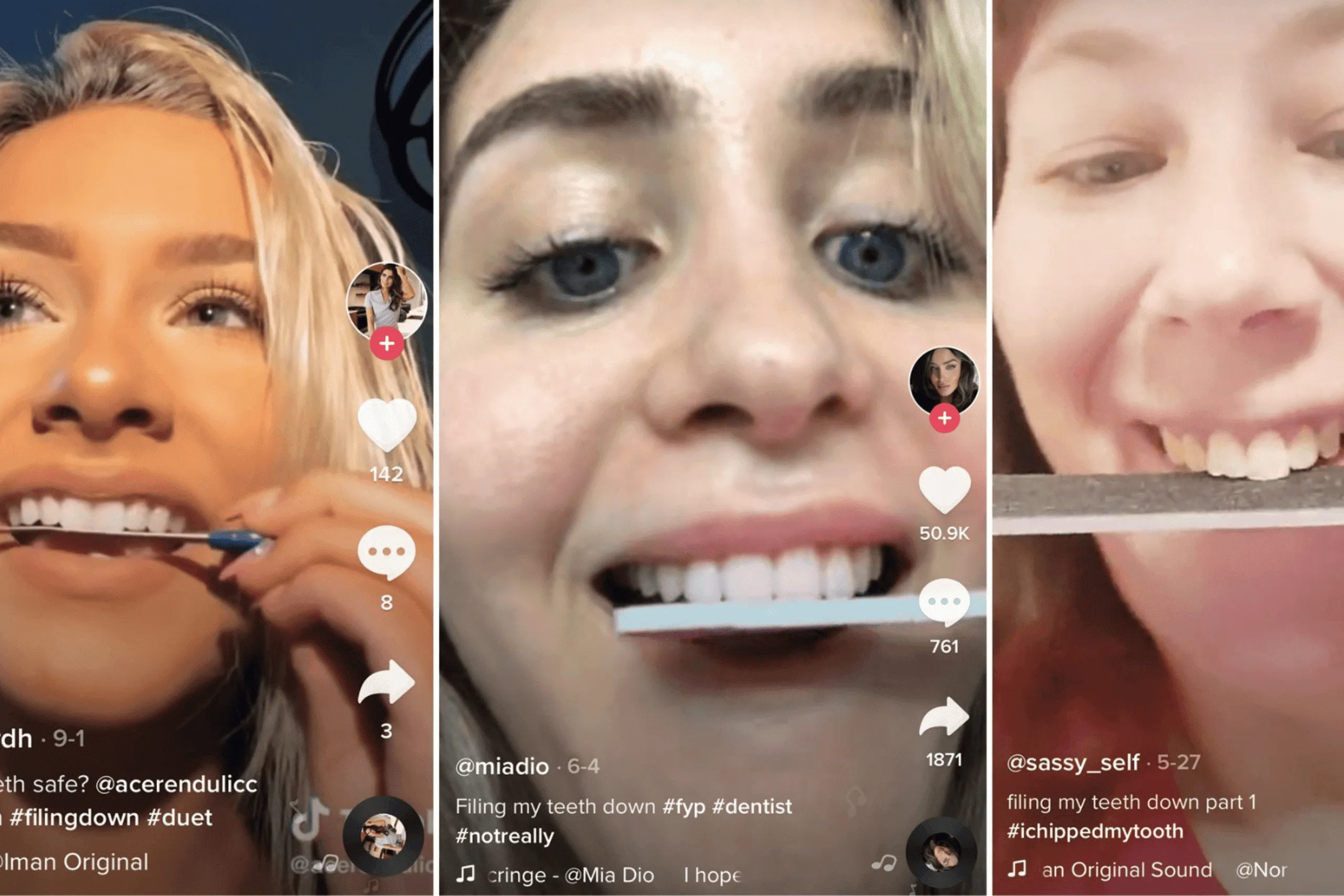29315 teeth whitening products tiktok
