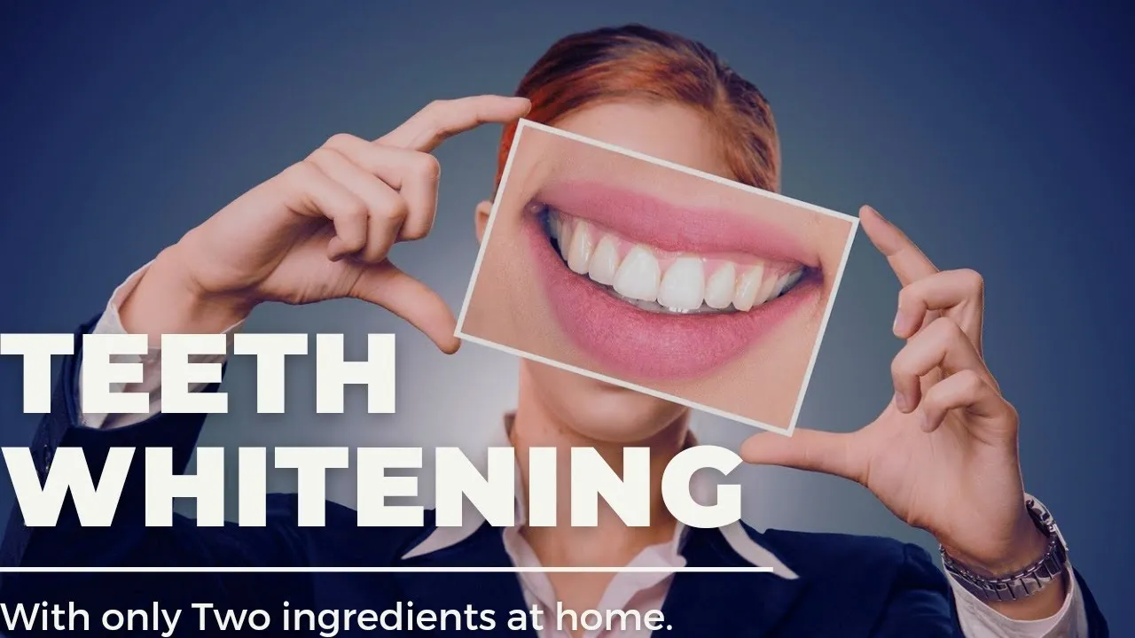 /img/29316-professional-whitening.webp