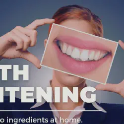 /img/29316-professional-whitening.webp