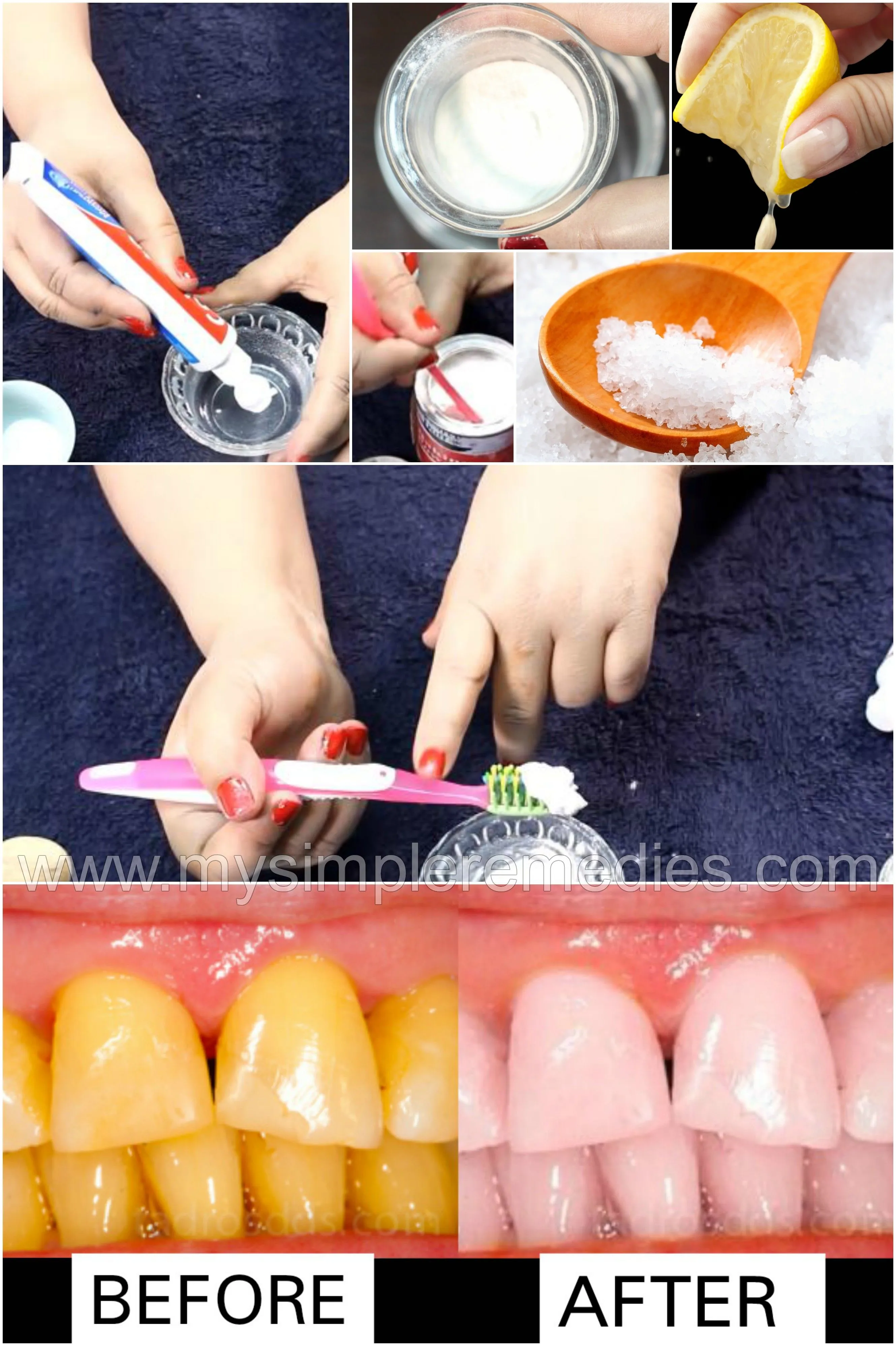 29316 strawberry teeth