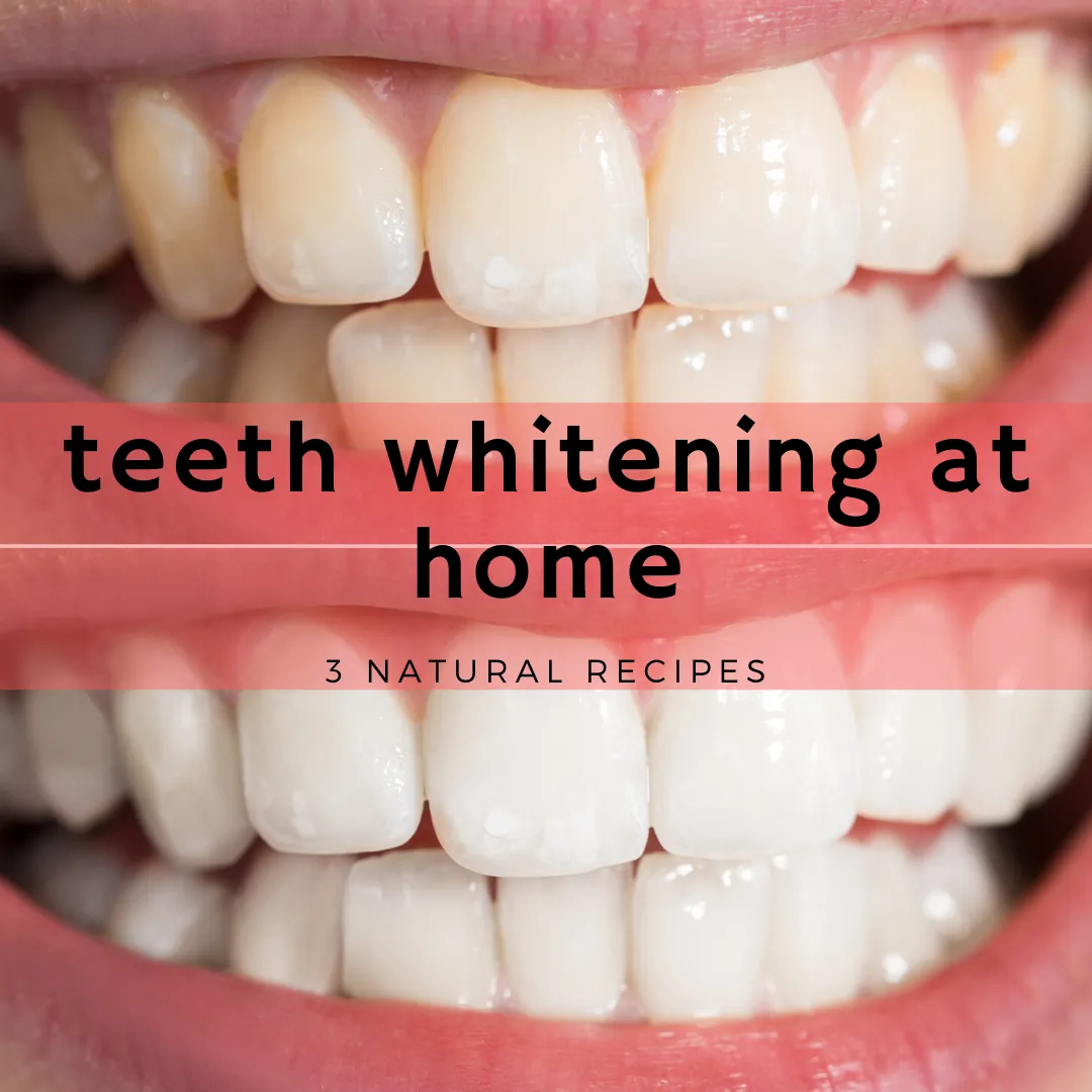 29316 teeth discoloration