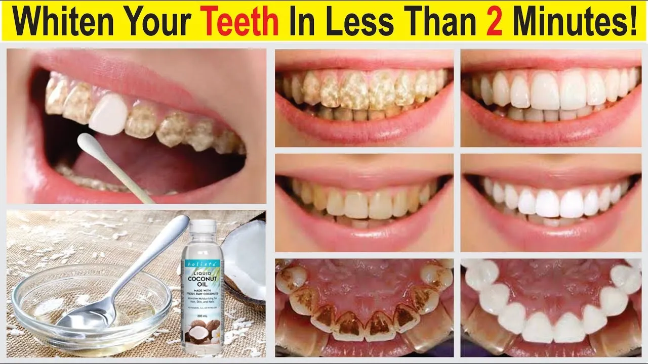 29316 turmeric teeth