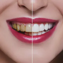 /img/29320-maintaining-white-smile.webp