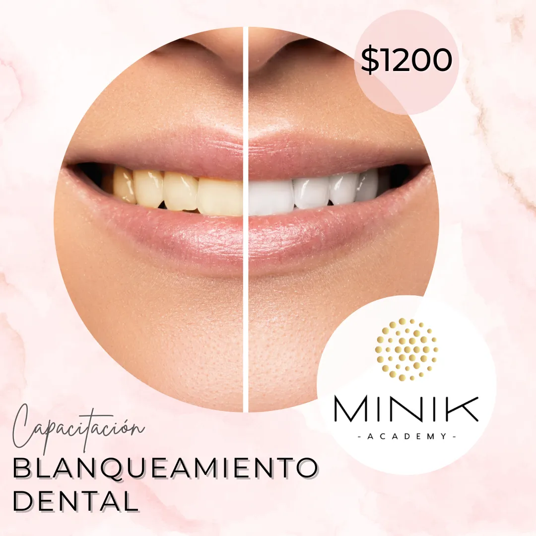 /img/29322-teeth-whitening-spanish-fork-confident-smile.webp