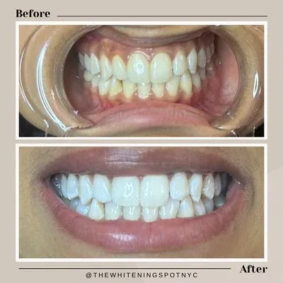29325 healthy smile
