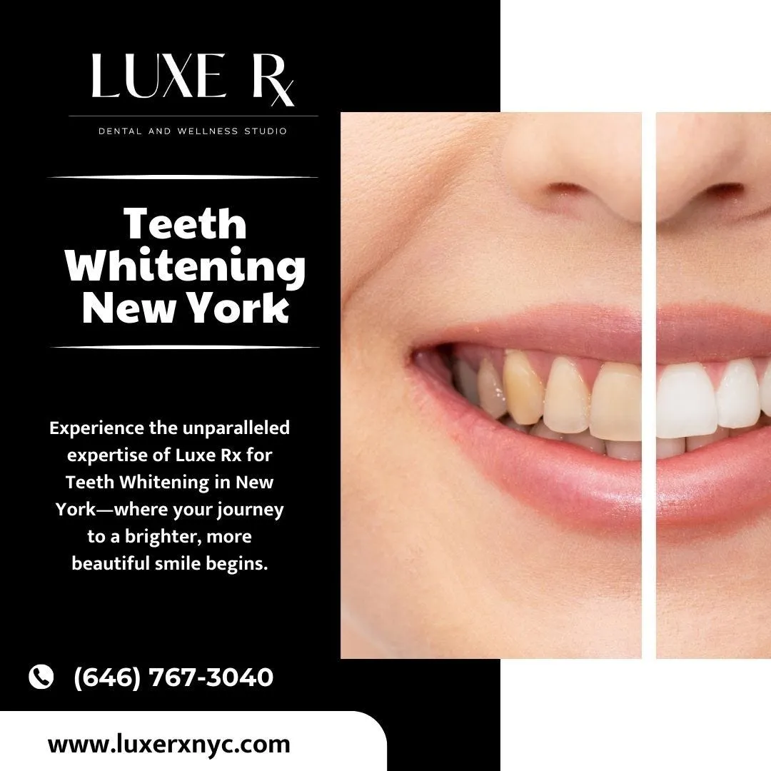 29325 whitening before after