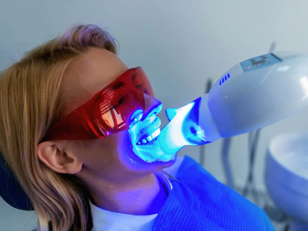 29326 in office teeth whitening