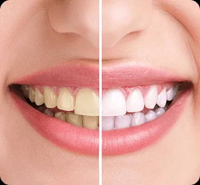 29328 regular dental checkups