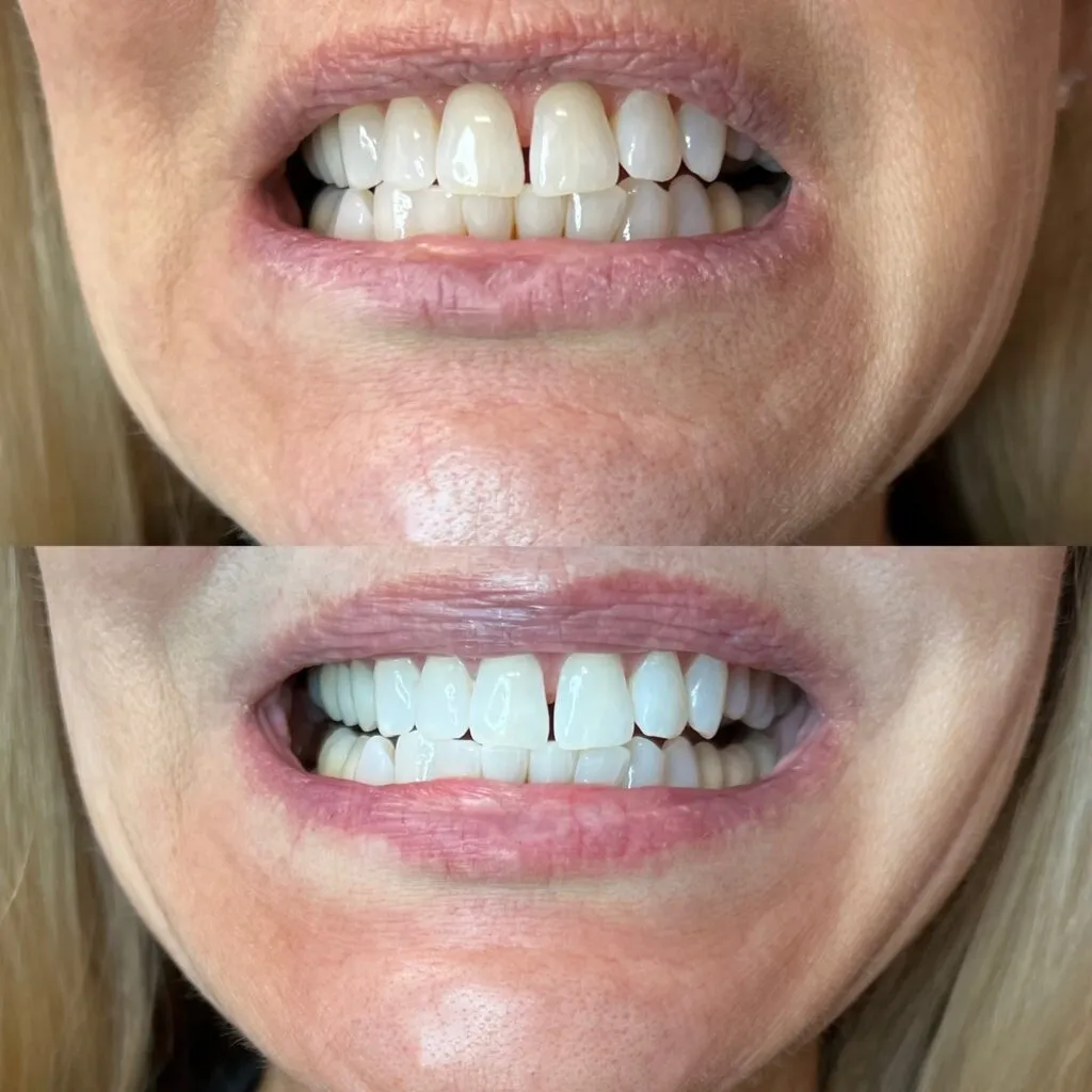 29335 green bay dentist consultation