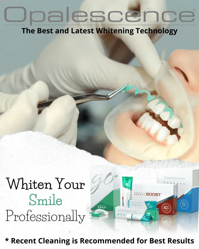 29335 teeth whitening green bay at home kit
