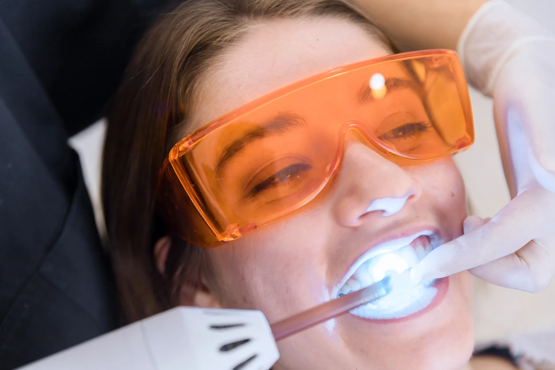 29337 laser teeth whitening risks