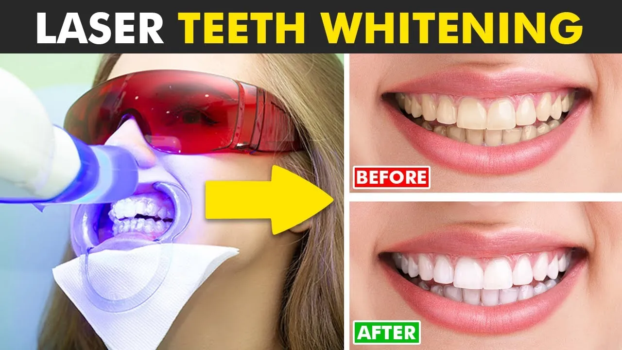 29337 teeth whitening aftercare