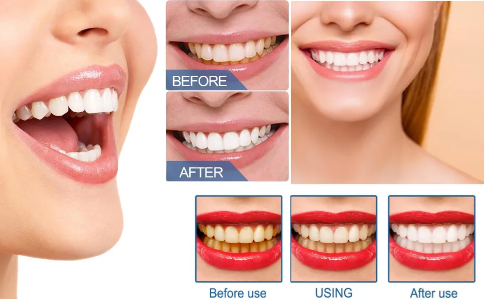 /img/29338-soda-powder-teeth-whitening-7.webp