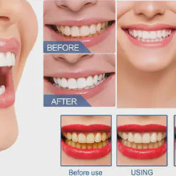 /img/29338-soda-powder-teeth-whitening-7.webp