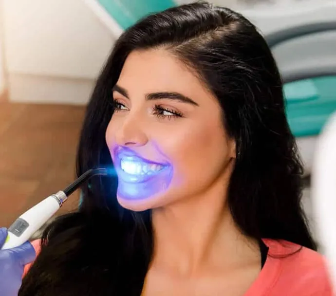29339 in office whitening procedure