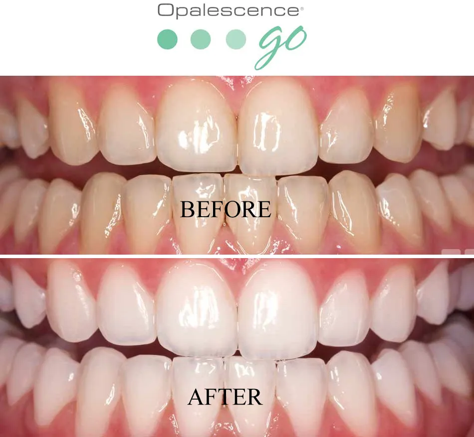 29340 smile maintenance