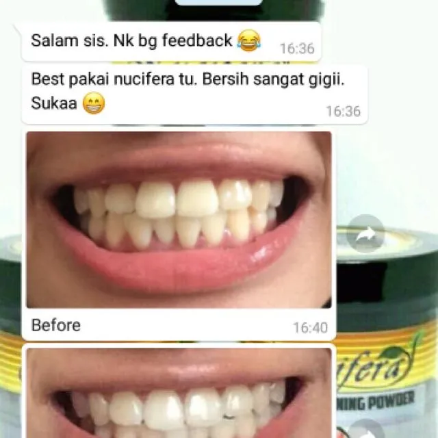 29343 nucifera teeth whitening before after