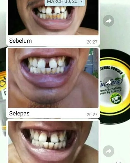 29343 nucifera testimonial 1