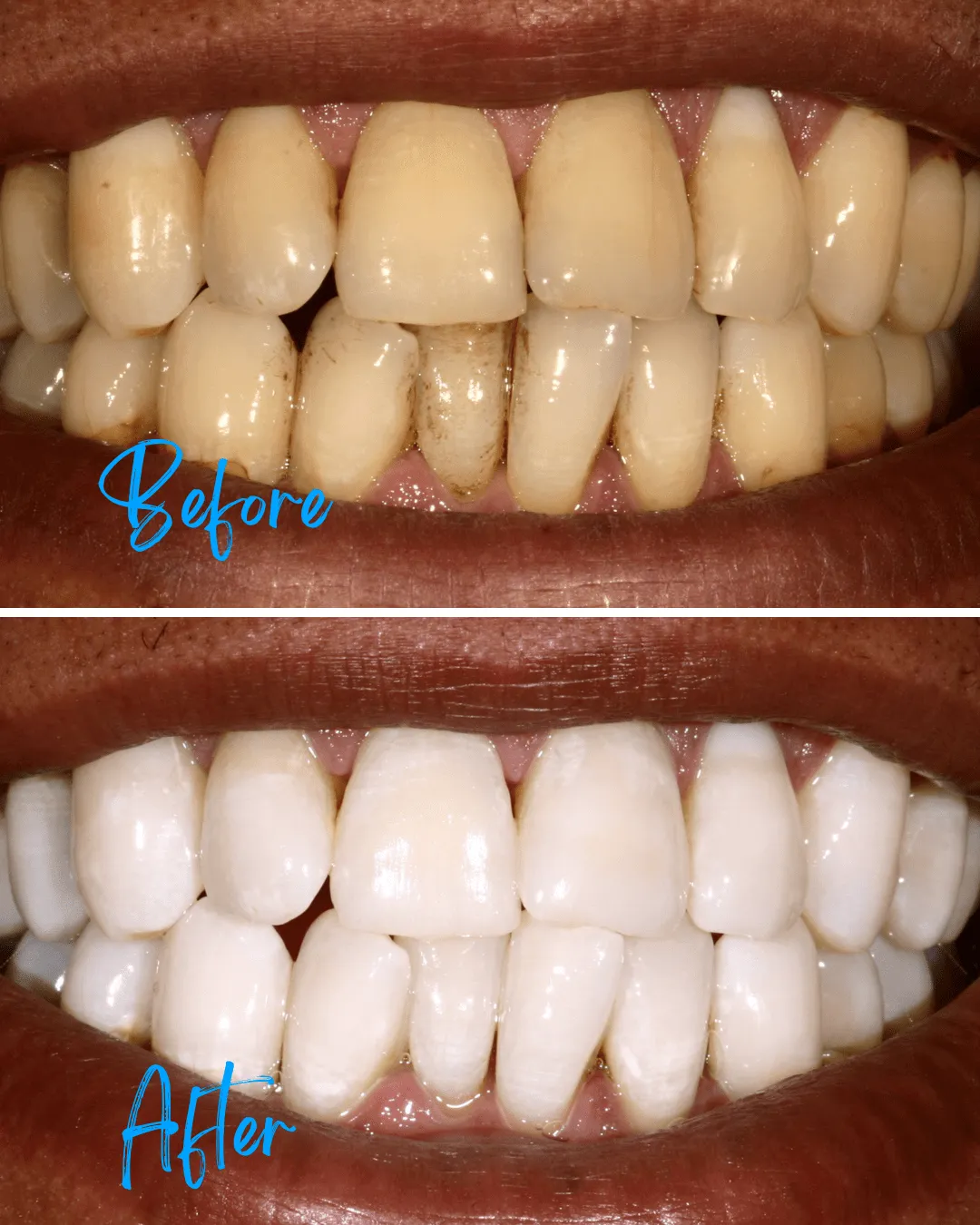 /img/29344-kor-whitening-cost-comparison.webp