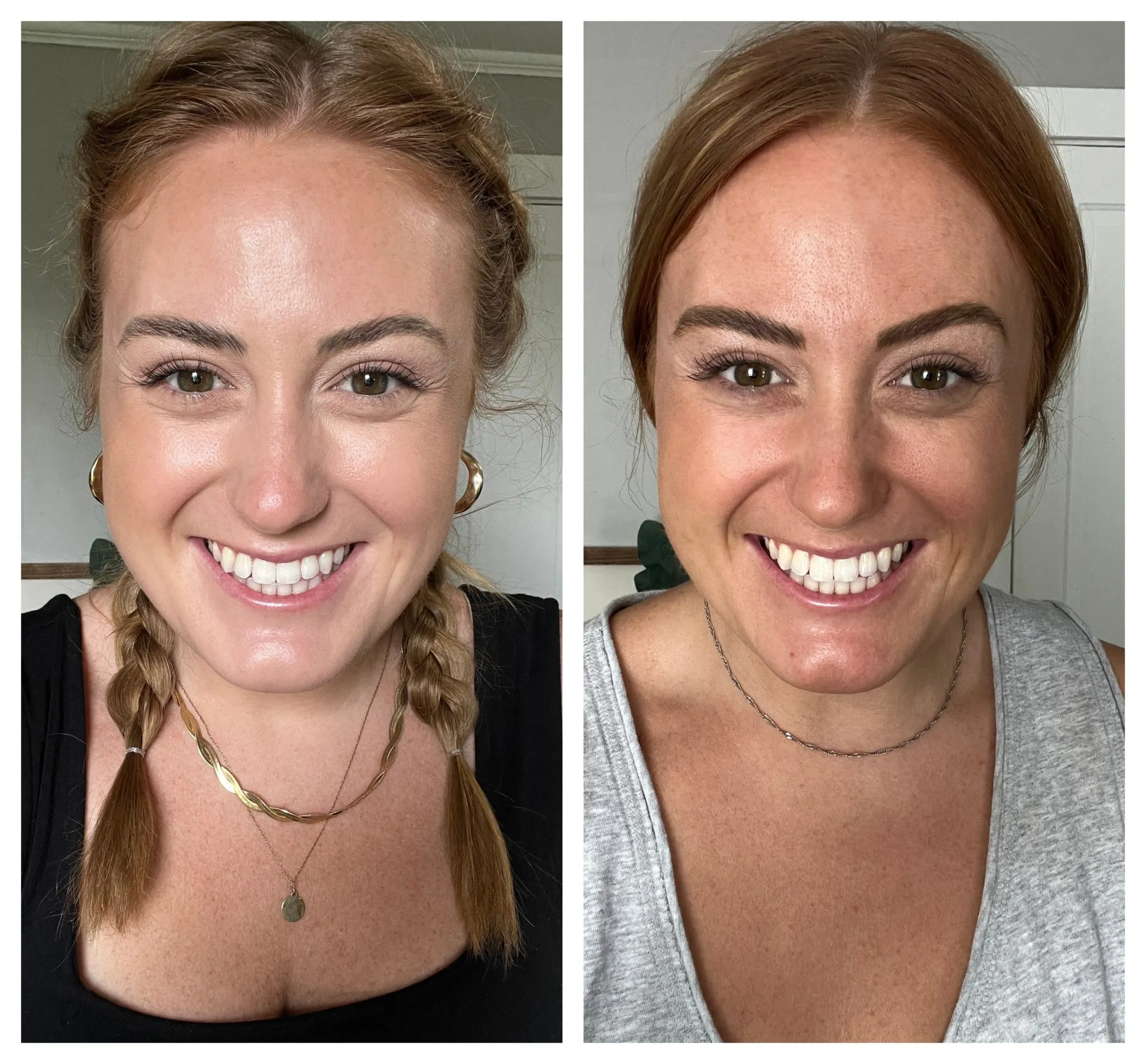 /img/29348-teeth-whitening-methods.webp