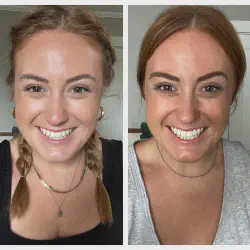 /img/29348-teeth-whitening-methods.webp
