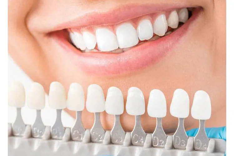 29352 teeth whitening process